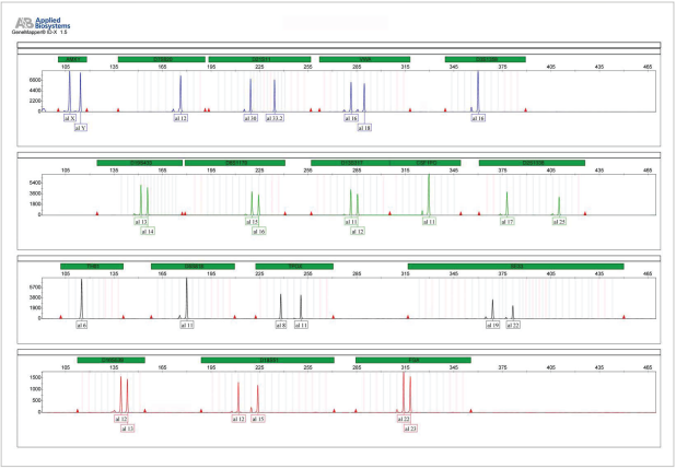 A profile of the Control DNA provided with GT Detector. One ng of DNA has been amplified using the kit
