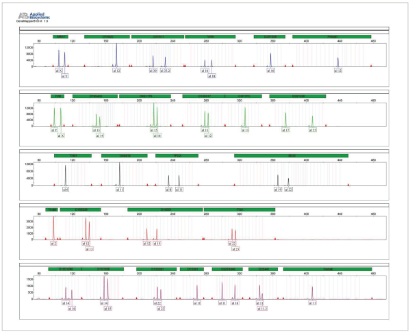 A profile of the Control DNA provided with GT Detector Globe