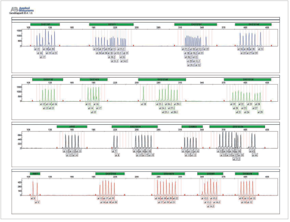 GT XDetector allelic ladder