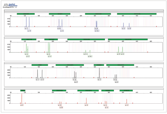  A profile of the Control DNA provided with GT XDetector.