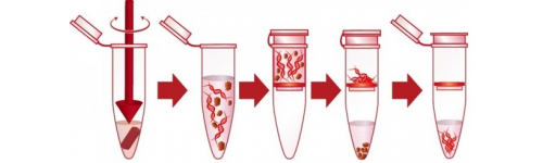 RNA kity